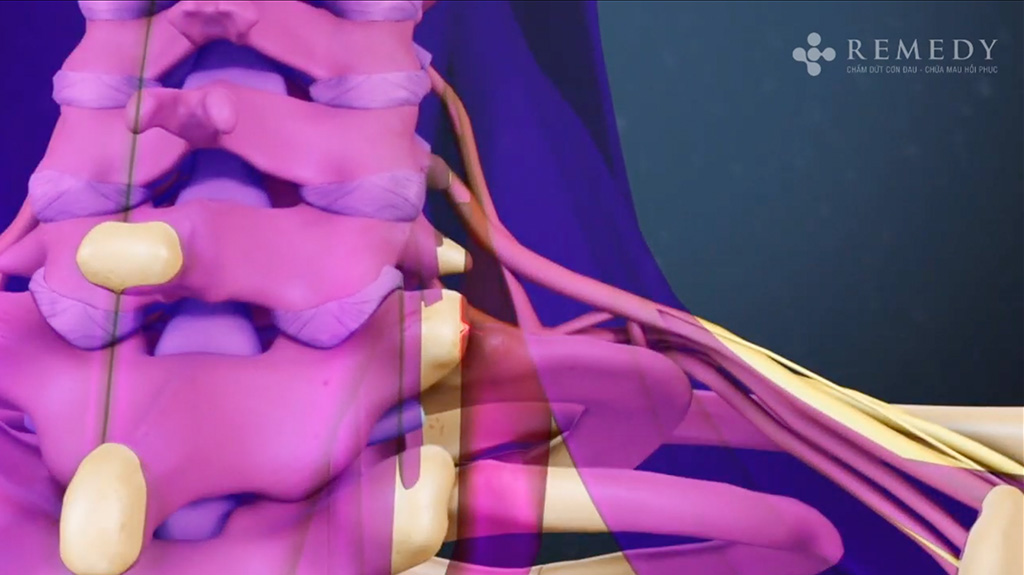 Video bệnh lý cơ xương khớp 37
