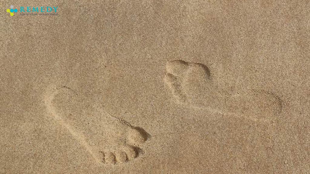 Dấu hiệu nhận biết bàn chân bẹt ở trẻ bằng cát