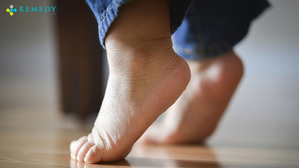 Nguyên nhân dẫn đến hội chứng bàn chân bẹt ở trẻ